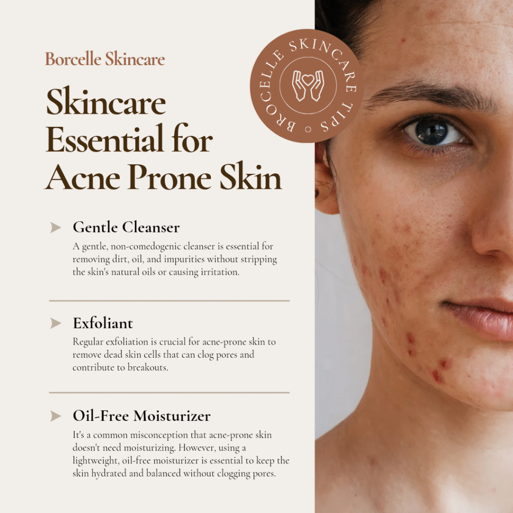 Best face wash for acne 