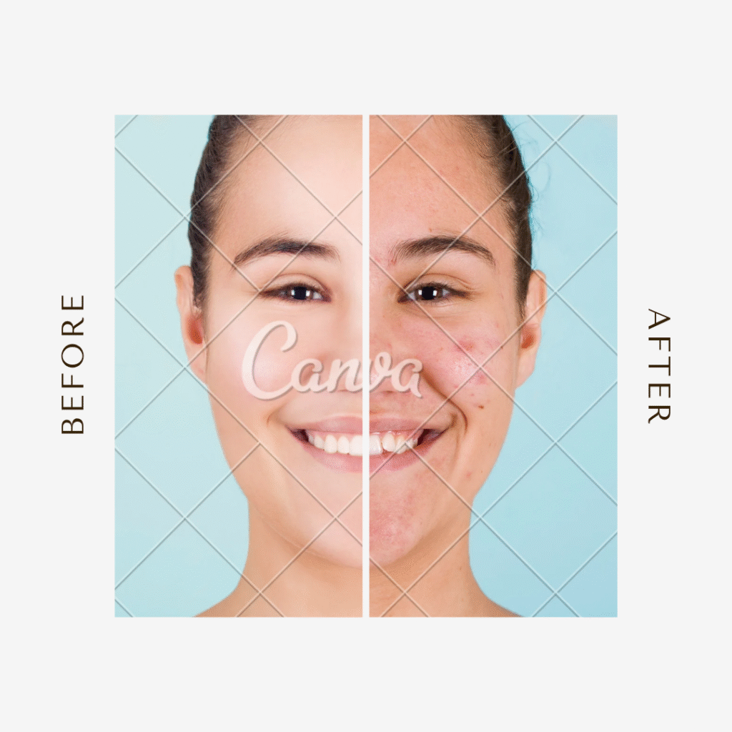 Best face wash for acne 